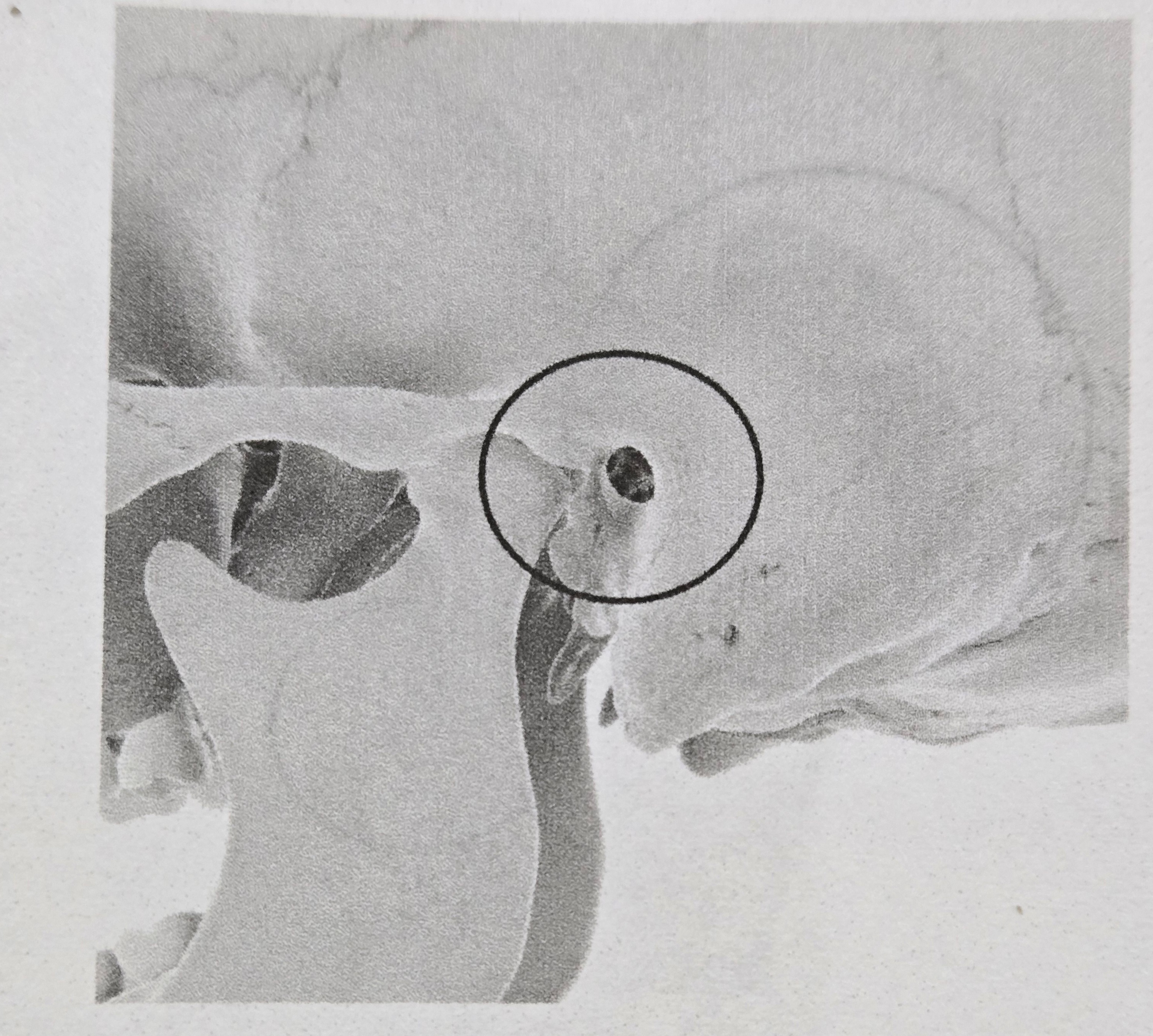 <p>Meatus </p>