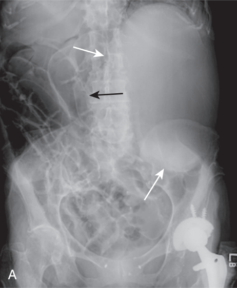 <p>diagnosis</p>