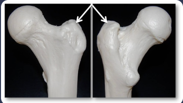 <p>large, rough projection </p>