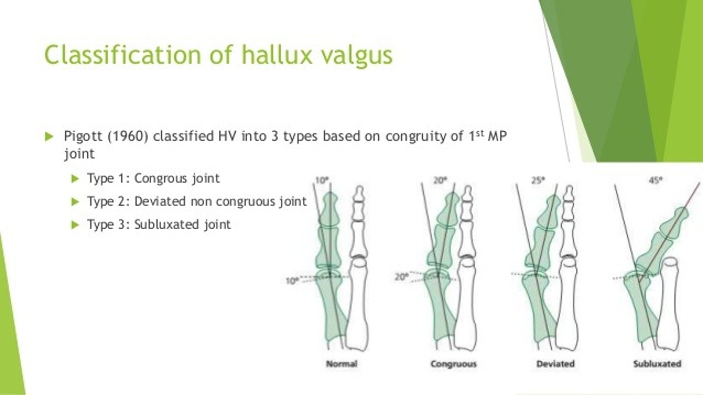 <p>Hallux Valgus Classifications (stages 1 - 4)</p><p>Stage 1</p><p>Excess pronation causes hypermobility of 1st ray. Tibial sesamoid ligament gets stretched</p><p>& fibular sesamoid ligament contracts.</p><p>Lateral subluxation of proximal phalanx occurs</p><p>Stage 2</p><p>Hallux abductus progresses, touches against 2nd digit</p><p>FHL & FHB gain lateral mechanical advantage</p><p>Crista starts to erode</p><p>Stage 3</p><p>Further subluxation at 1st MPJ, formation of IMA</p><p>IMA increases secondary to retrograde forces from abductor hallucis</p><p>Stage 4</p><p>Hallux subluxes & dislocates on 1st metatarsal</p><p>Increased crista erosion</p>