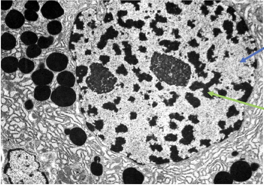 <p>what type of DNA is the green arrow pointing to </p>