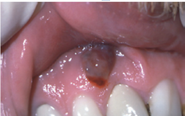 <p>1.what is this lesion?</p><p>2. how to treat/ manage it?</p><p>3. classification of oral lesion in HIV?</p>