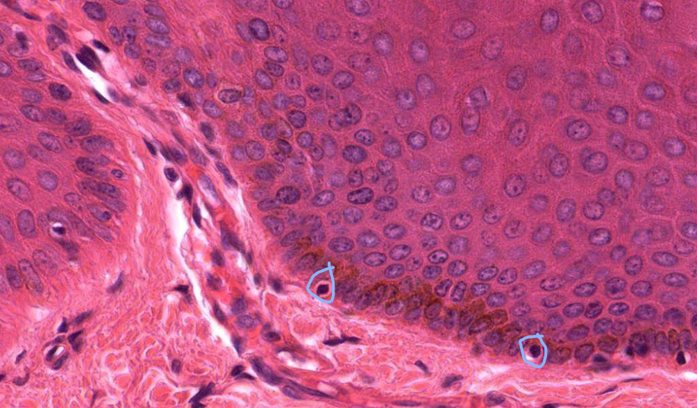 <p>What is the circled cell?</p>