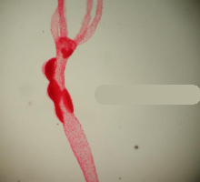 <p>what genus and stage is this</p>