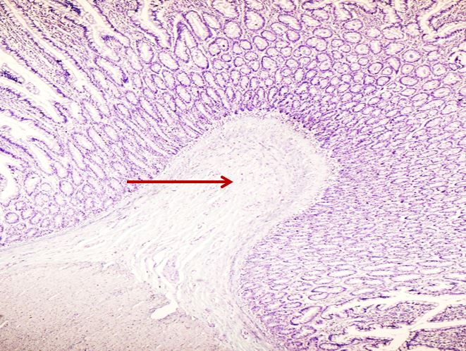 <p>Tầng gì ? - Tiêu bản gì ?</p>