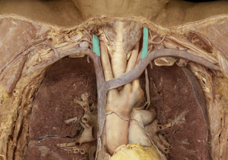 <p>Identify the feature of the superior vena cava</p>