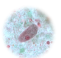 <ul><li><p><mark data-color="#8a9d01" style="background-color: rgb(138, 157, 1); color: inherit;">JUNKY CYTOPLASM </mark></p></li><li><p>LARGE ECCENTRIC (non-centered) karyosome </p></li><li><p>HUGEEEE think “entera coli”<mark data-color="#a6a600" style="background-color: rgb(166, 166, 0); color: inherit;"> 15-50um</mark></p></li><li><p>NO/SLUGGISH MOTILITY</p><ul><li><p>flexible pseudopod extension</p></li></ul></li></ul><p></p>