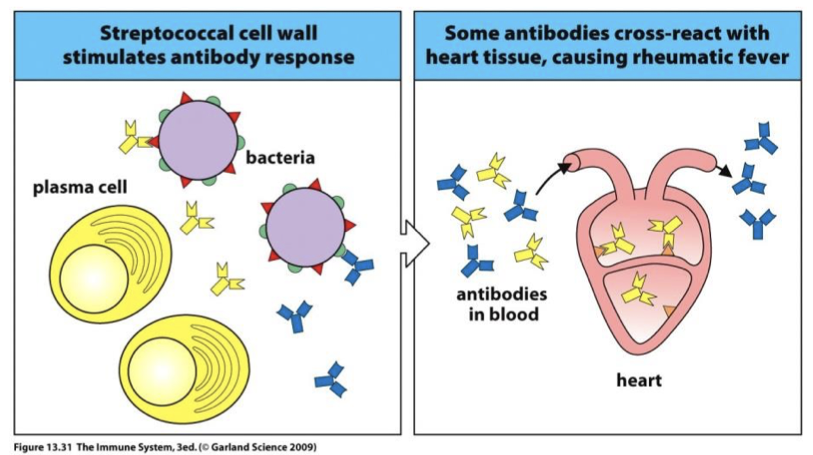 <p>Infection elicits immune response. Molecular mimicry cause Ab to cross-react with self- tissue.</p>
