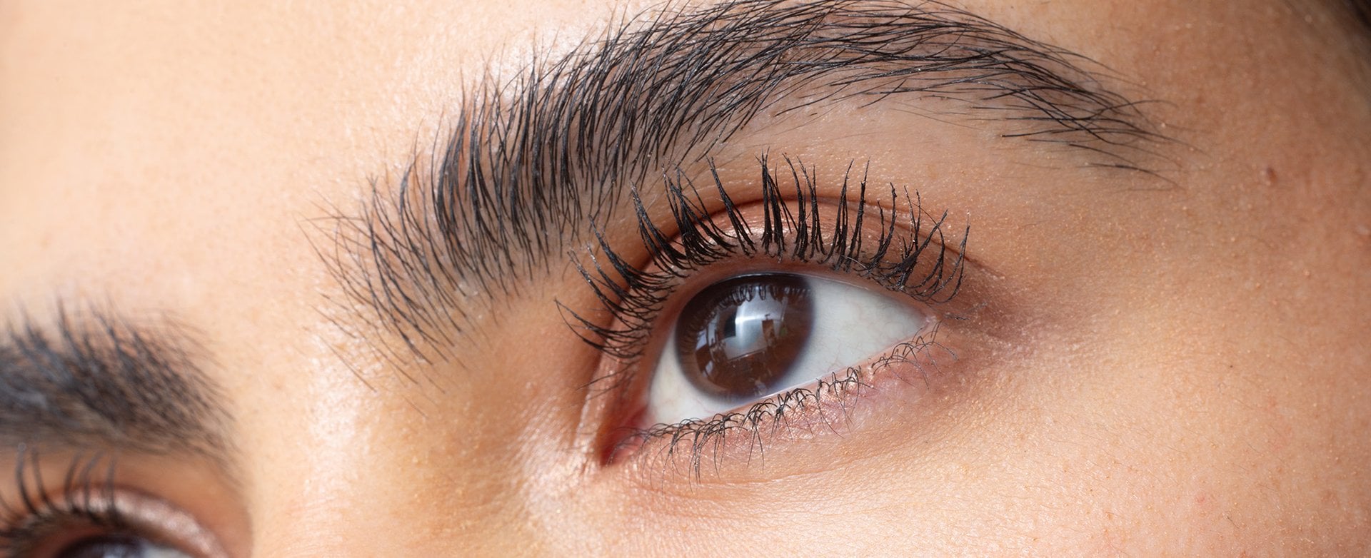 <p>bushy eyebrows</p>