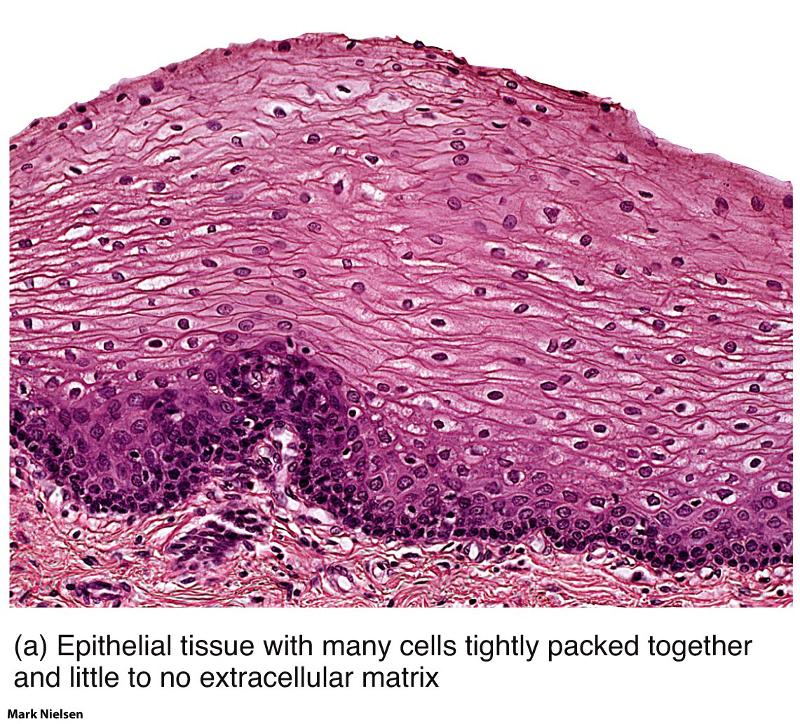 <ul><li><p><em>Characteristic Feature: </em>epithelial cells; several layers thick</p></li><li><p><em>Cell shape/Characteristics</em>: upper layer, squamous; middle layer, cuboidal; basal (bottom) layer, columnar</p></li><li><p><em>Function:</em> tough layers of cells providing protection to underlying tissues</p></li><li><p><em>Location: </em>outer layer of skin and lining of mouth</p></li></ul><p></p>