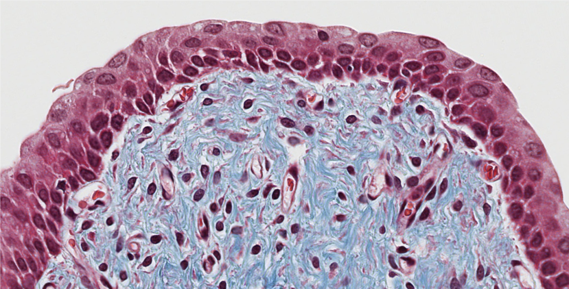 <p><span style="font-family: "Calibri Light";">1. ID the epithelium lining the surface of this tissue.<br><br>2. Is this epithelium simple or stratified?</span></p>