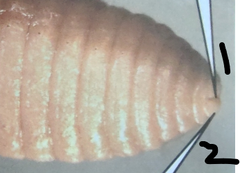 <p>What is point 2 on this earthworm </p>