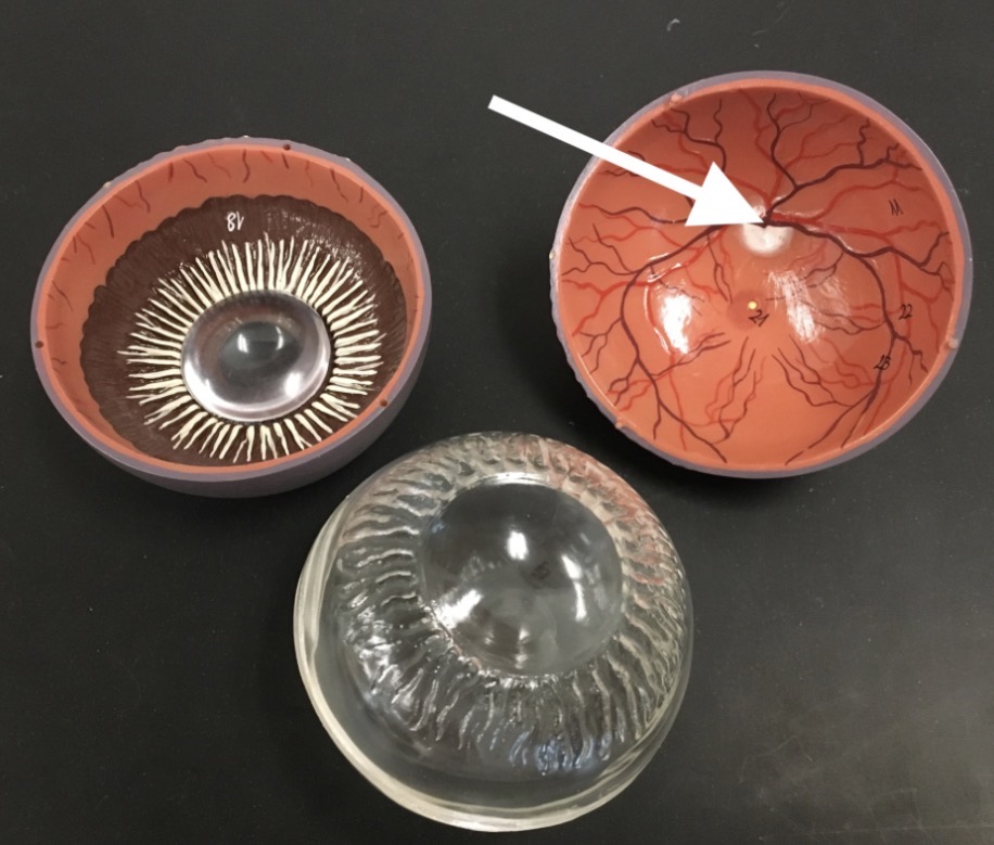 <p><span>name the CIRCLE structure at the end of the arrow's point</span></p>