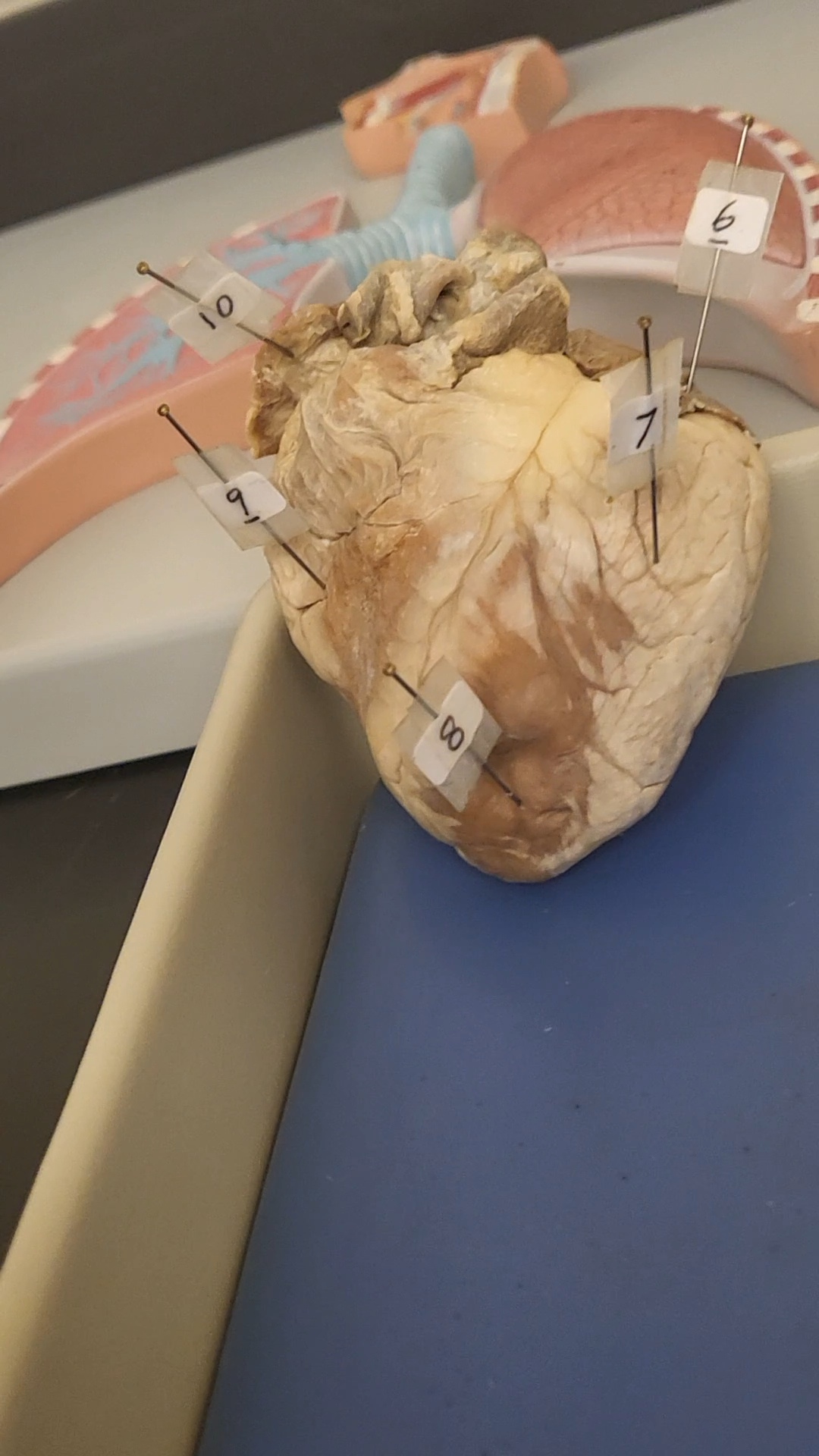 <p>identify 9</p>