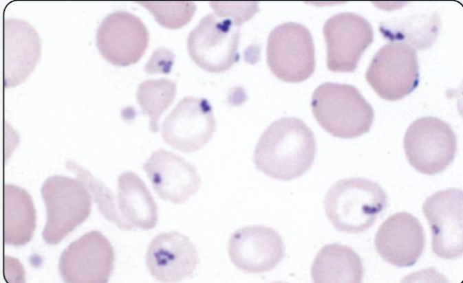<p>What cellular inclusion is shown? What is it composed of? What anemia is it most associated with?</p>