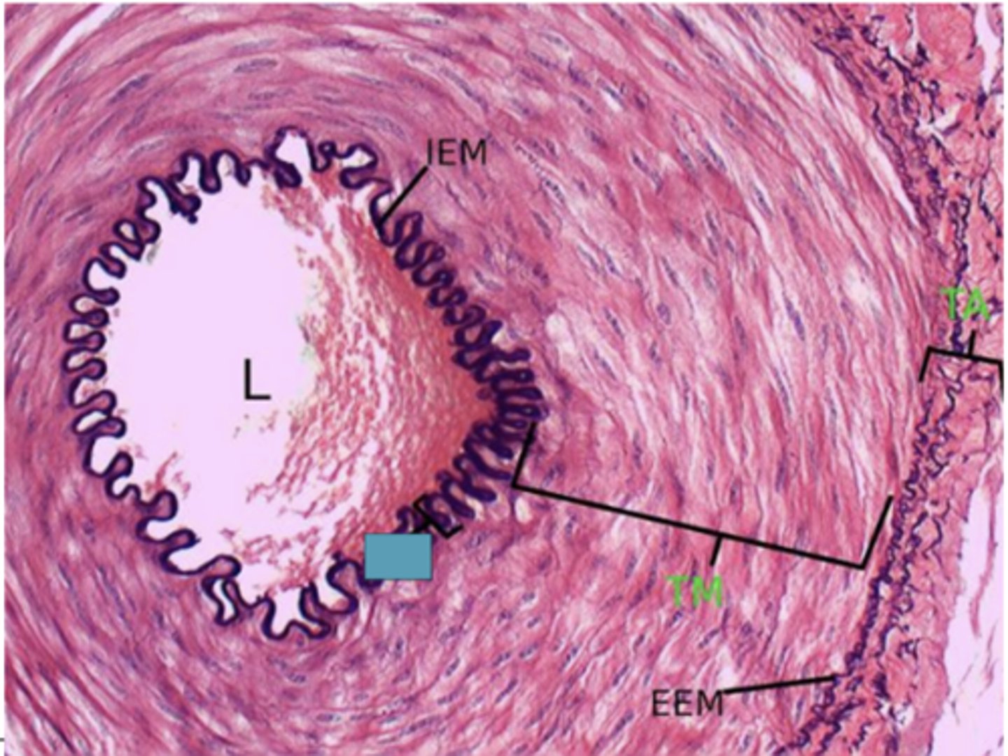<p>Identify the layer of the vessel</p>