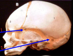 <p>What structure is labeled 1 on the developing skull?</p>