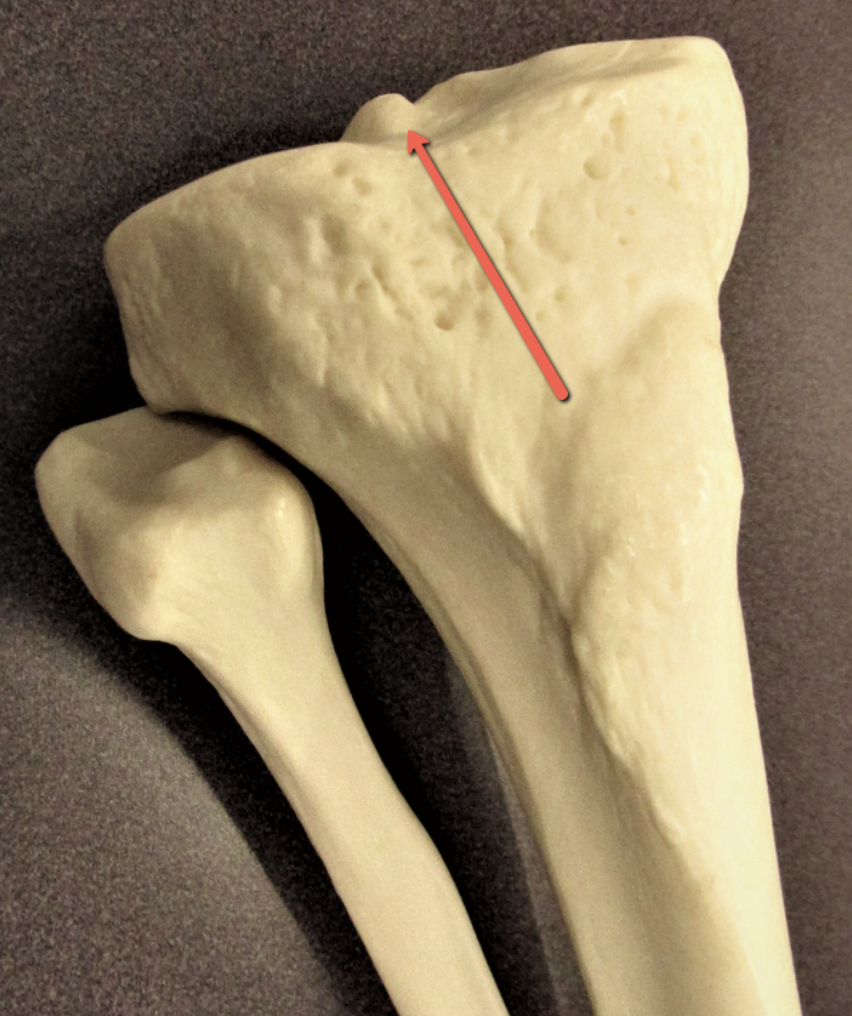 <p><strong>Identify the bone marking indicated by the pointer.</strong></p>