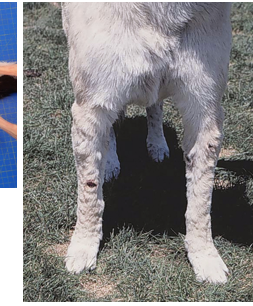 <p>What is this cutaneous manifestation?</p>