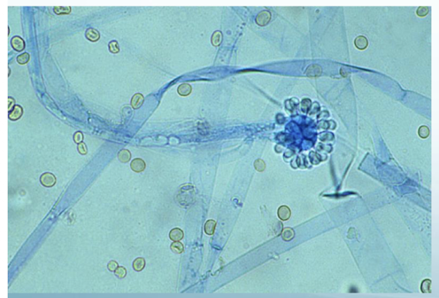 <p>Genus </p>