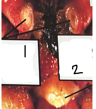 <p>what is point 2 on this crayfish </p>