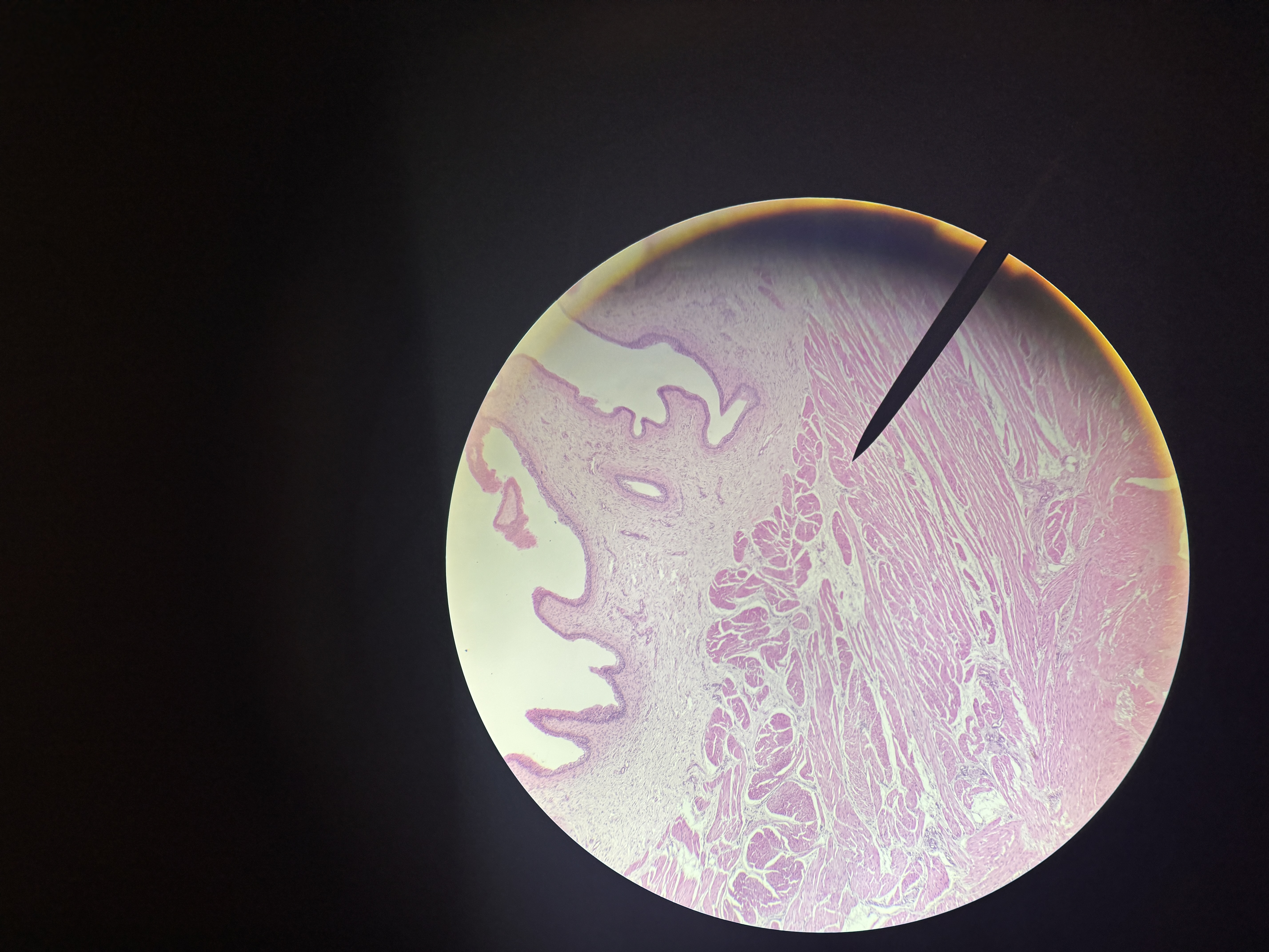 <p>What slide is this?</p>