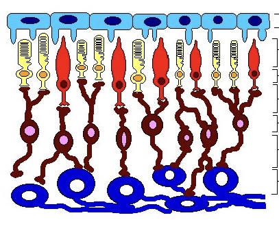 term image