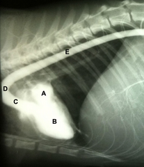 <p>Identify the structures labeled A and B:</p><p>1. A) Left Atrium B) Left Ventricle</p><p>2. A) Left Ventricle B) Left Atrium</p><p>3. A) Ascending Aorta B) Left Ventricle</p>