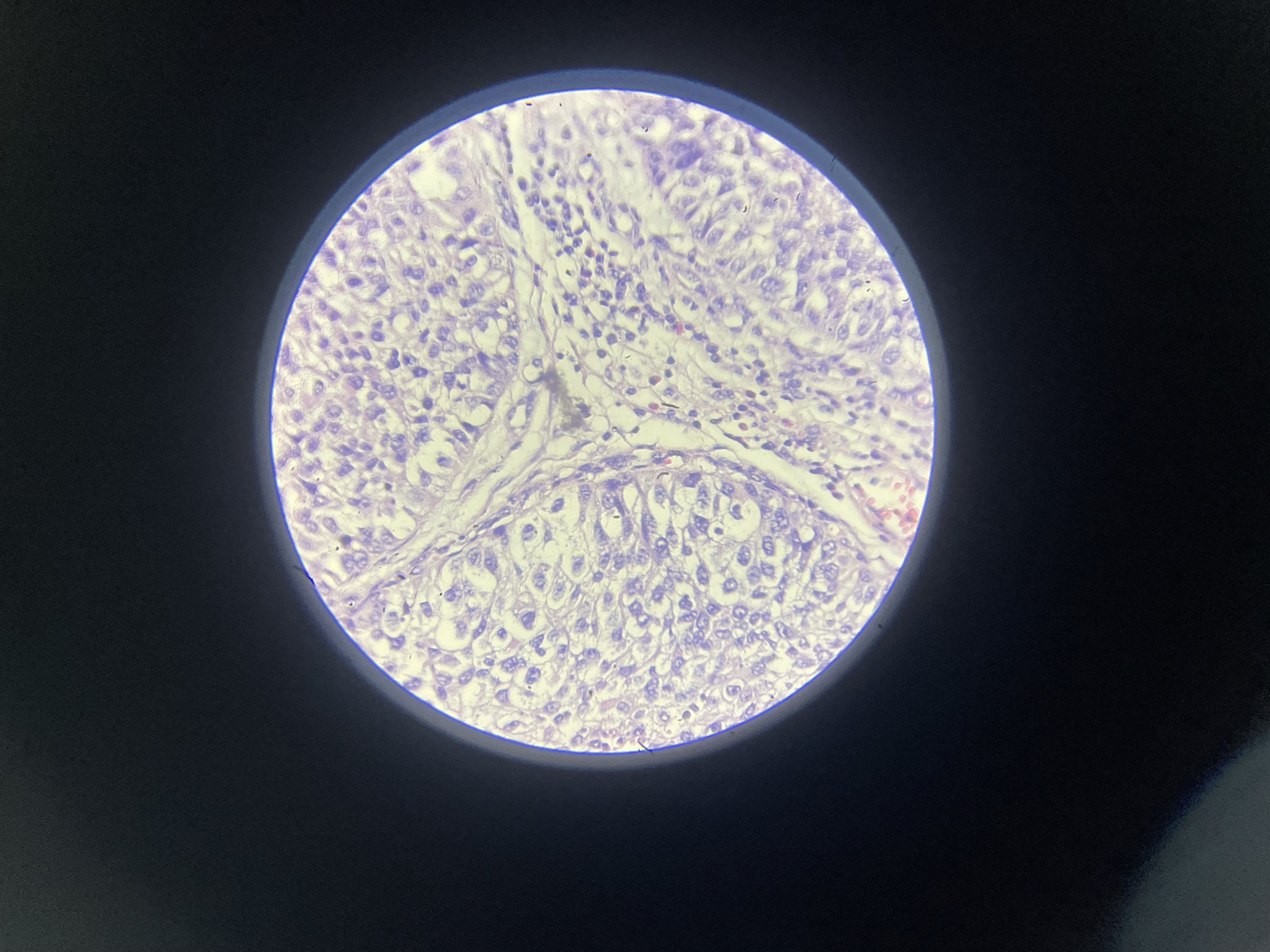 <p>What is the diagnosis?</p>