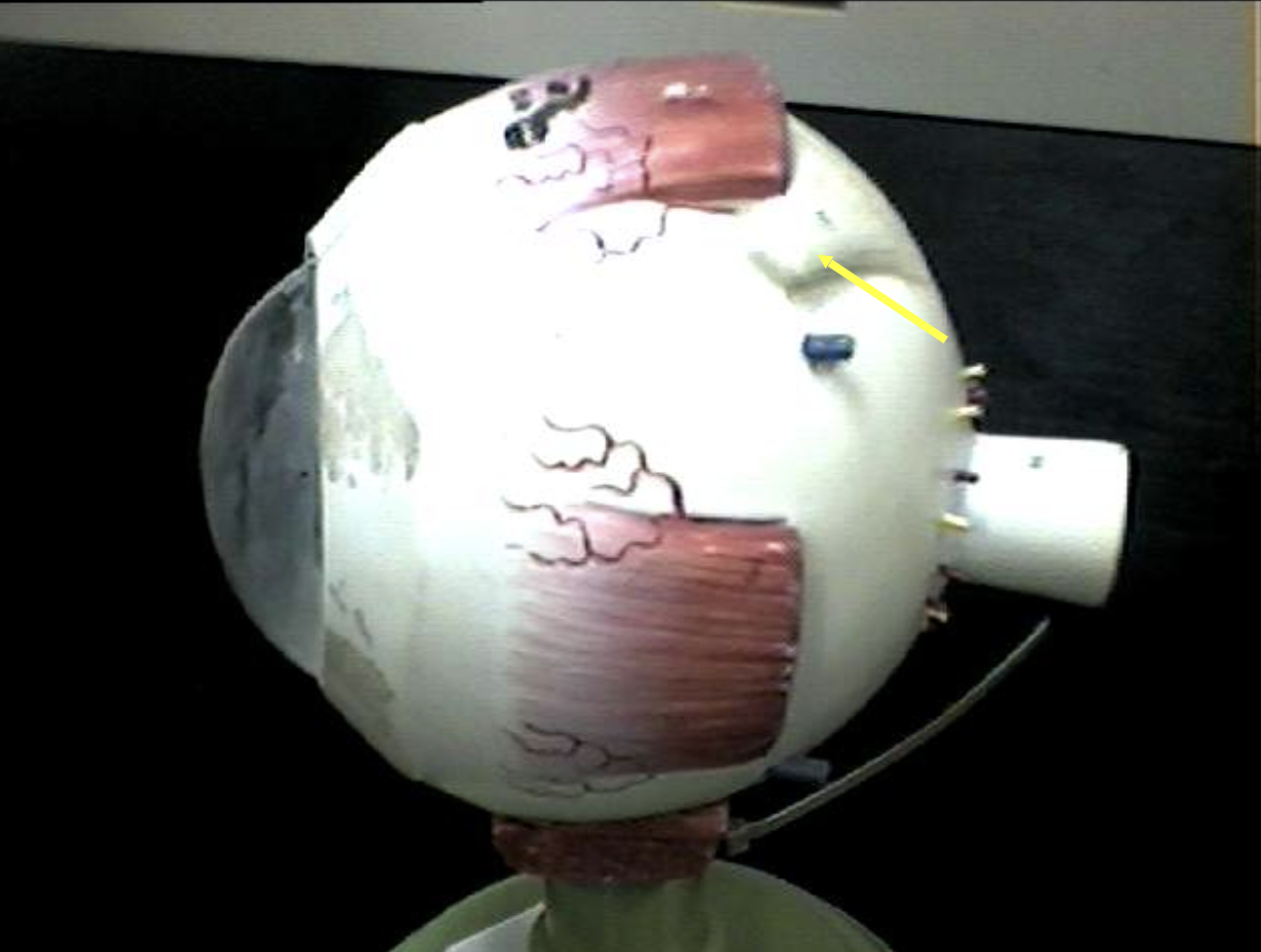 <p>Identify the eye parts. </p>