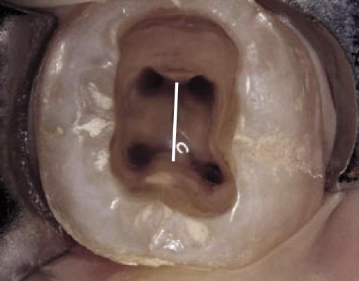 <p>What is the 1st Law of Symmetry?</p>