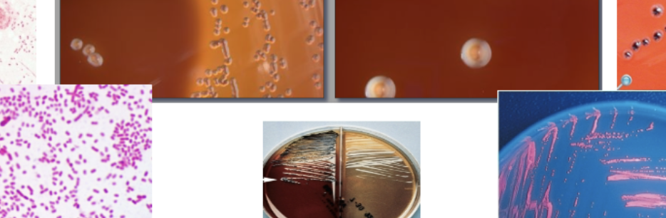 <p>GNR, pairs or short chains, ANA BAP- white circular convex shiny gamma fluoresces brick red, LKV black</p>