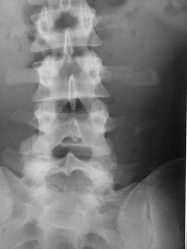 <p>What is the doagnosis?</p>