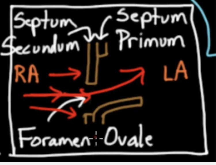 <p>flap in the 2 walls separating the RA and the LA</p><p>wall 1: septum primum</p><p>wall 2: septum scundum</p>