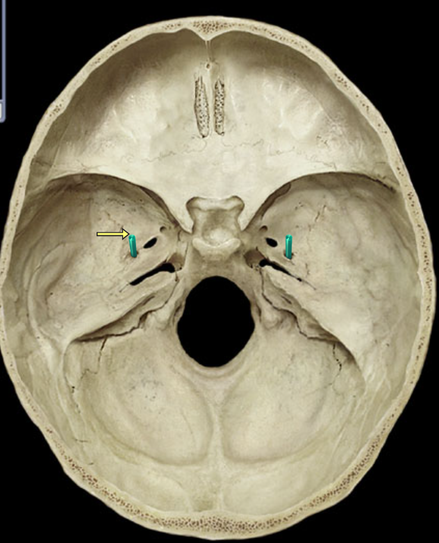 term image