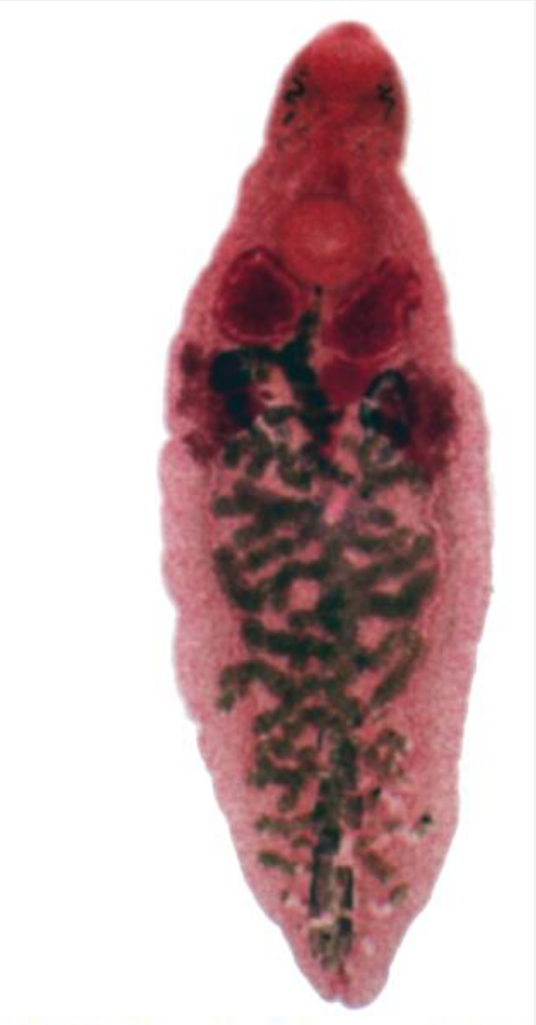 <p>Name this Trematode</p>