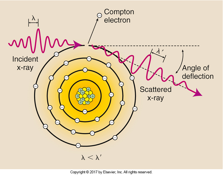 <p>X-Radiation produces noise, reducing image contrast and contrast resolution. Makes image less visible</p>