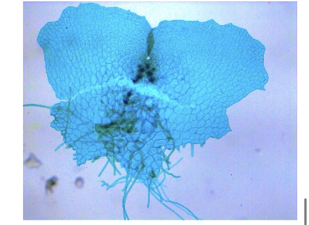 <p><span><span>What type of spore and spore development pattern is found in this taxa</span></span></p>