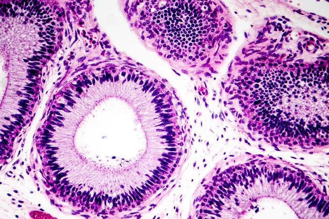 <p>Type of tissue</p>