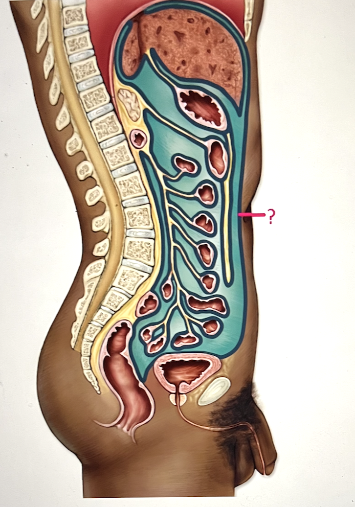<p>identify the serous membrane. be sure to include whether it is visceral or parietal layer in your answer. </p>