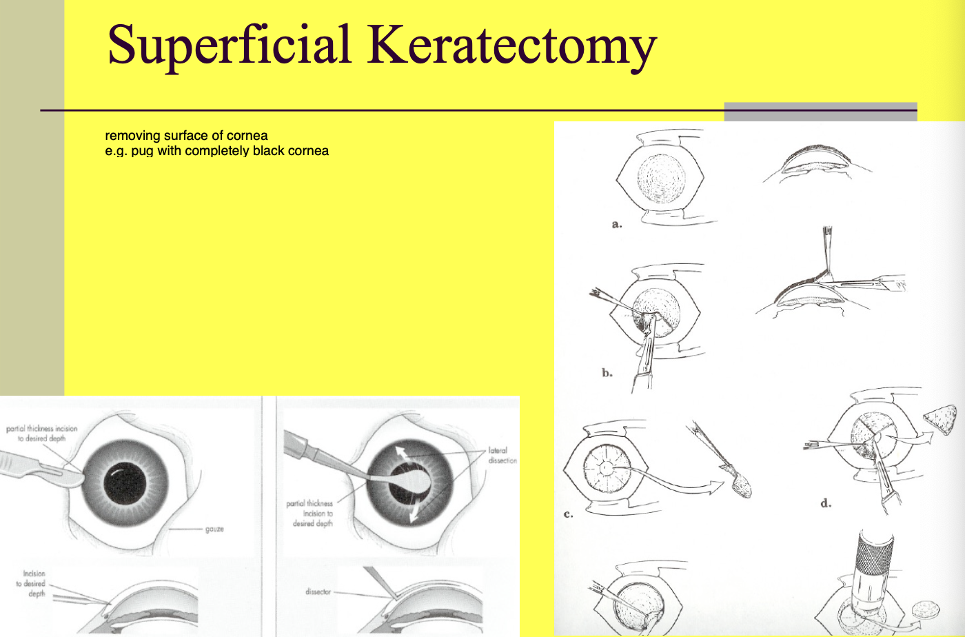 <p>removal of the superficial cornea surface</p>