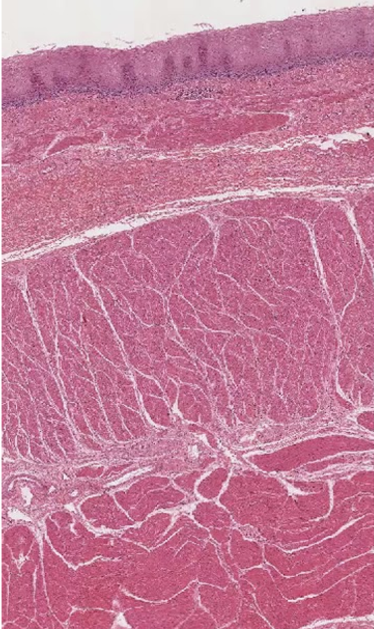 <p>this is a picture of the </p>