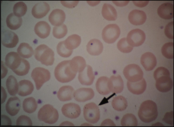 <p>This image shows?</p>