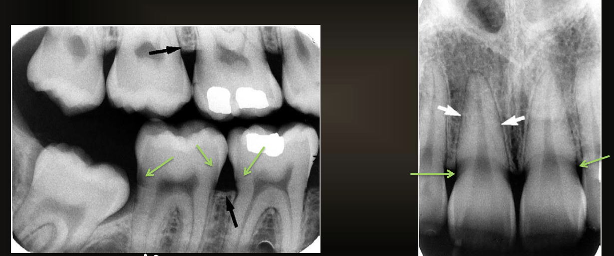<p>what are the arrows pointing at?</p>