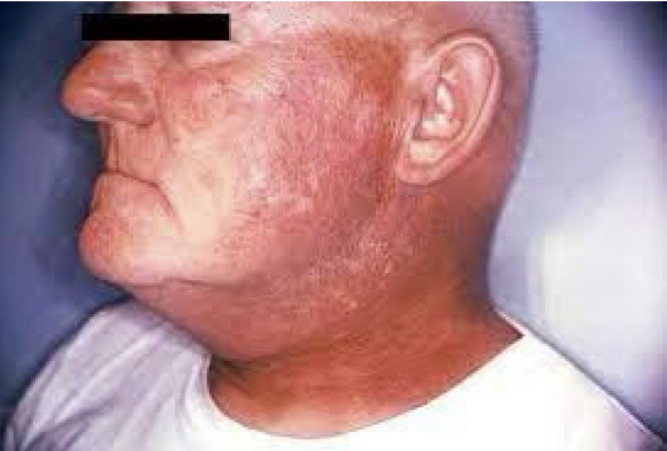 <p>CHẨN ĐOÁN?</p>