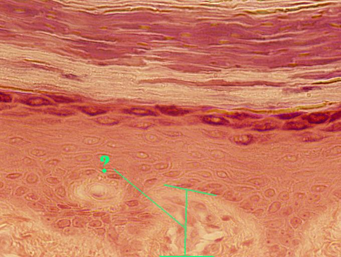 <p>Identify the indicated layer of the skin</p>
