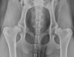 <p>Hip dysplasia?</p>
