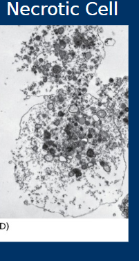 <p><span style="color: rgb(0, 0, 0);"><span>• Cell death by </span><strong><span>necrosis</span></strong><span><br></span><span>• Less organized</span><span><br></span><span>• Cell rupture spills cell contents into tissue</span><span><br></span><span>• Generally causes inflammation and associated with negative outcomes</span></span></p>