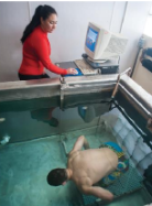 <p>Densitometry measures body density using hydrostatic (underwater) weighing. It works because muscle is denser than water (sinks) while fat is less dense than water (floats), allowing estimation of body fat percentage from overall body density. It is one of the most commonly used methods.</p><p>However, it has limitations:</p><ul><li><p>Lung air volume can affect buoyancy and skew results</p></li><li><p>Converting body density to percent body fat requires assumptions</p></li><li><p>Fat-free mass density varies between individuals, which can reduce accuracy</p></li></ul><p></p>