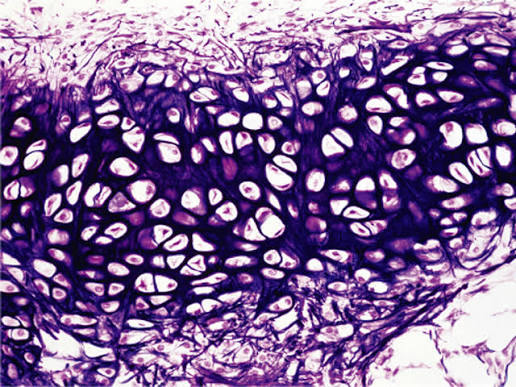 <p>Elastic Cartilage (Flexible Support)</p>